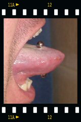 Micha's Tongue Piercing