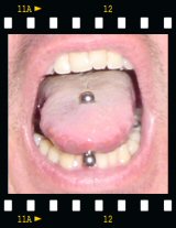 Micha's Tongue Piercing